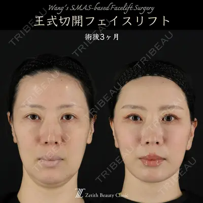 Zetith Beauty Clinic 新宿院 王 蘇医師の症例