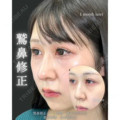 eクリニック 福岡院 伊藤 渉医師の症例