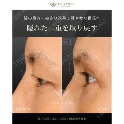 Otus Clinic 【オータスクリニック】 中 徳太郎医師の症例