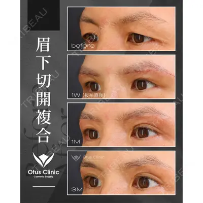 Otus Clinic 【オータスクリニック】 中 徳太郎医師の症例