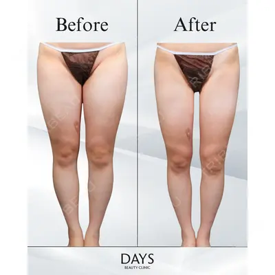 Days Beauty Clinic 本厚木院の症例