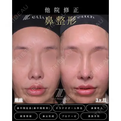 Zetith Beauty Clinic 福岡院 羽根 和秀医師の症例