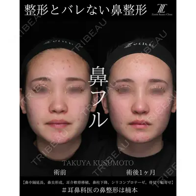 Zetith Beauty Clinic 大阪心斎橋院 楠本 拓哉医師の症例
