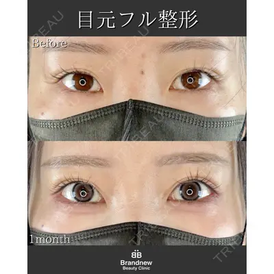 Brandnew Beauty Clinic 平山 容成医師の症例