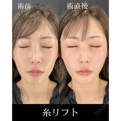 HAAB×DREAM BEAUTY CLINIC 大阪梅田院 柏木 太雅医師の症例