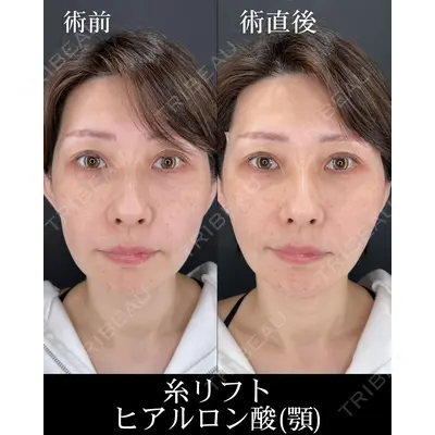 HAAB×DREAM BEAUTY CLINIC 大阪梅田院 柏木 太雅医師の症例