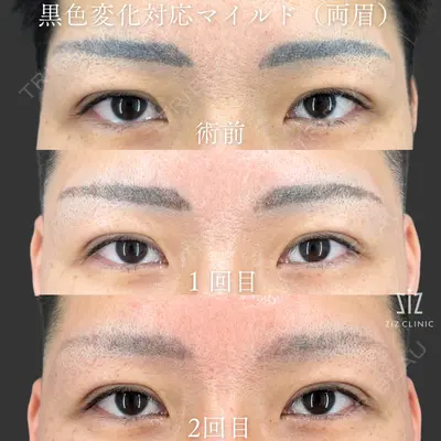 ziz CLINIC 村岡 史子医師の症例