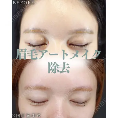 HAAB BEAUTY CLINIC 南青山本院（新院） 小平 佳典医師の症例