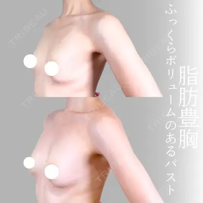 アリエル美容クリニック 横浜院 加藤 敏次医師の症例