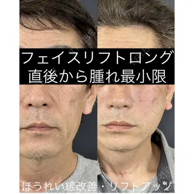 ルラ美容クリニック 渋谷本院 武内 大医師の症例