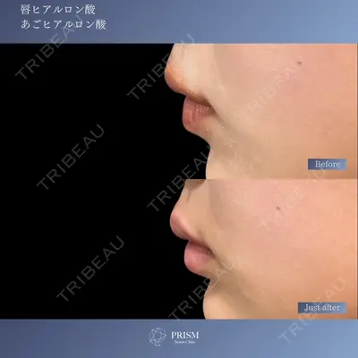 PRISM Beauty Clinic 新宿院 畑山 知輝医師の症例