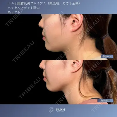 PRISM Beauty Clinic 新宿院 畑山 知輝医師の症例