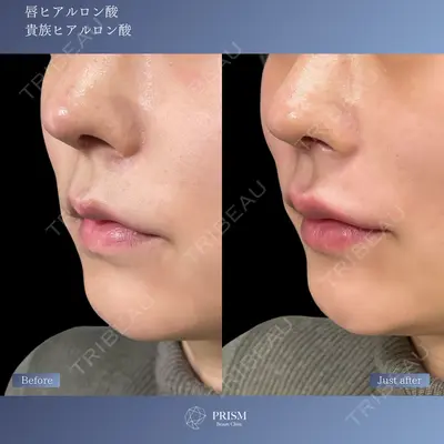 PRISM Beauty Clinic 新宿院 畑山 知輝医師の症例