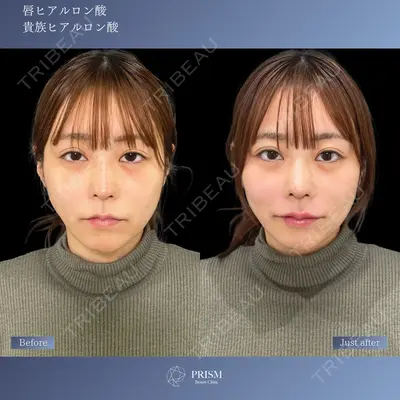 PRISM Beauty Clinic 新宿院 畑山 知輝医師の症例