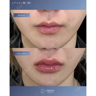 PRISM Beauty Clinic 新宿院 畑山 知輝医師の症例