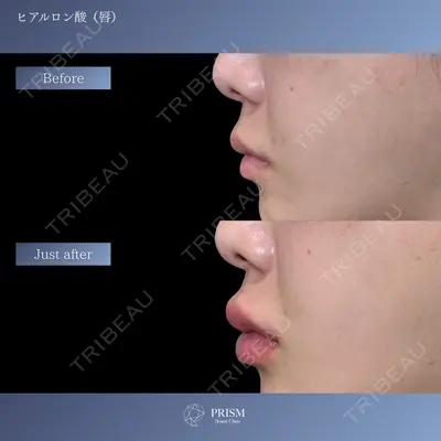 PRISM Beauty Clinic 新宿院 畑山 知輝医師の症例