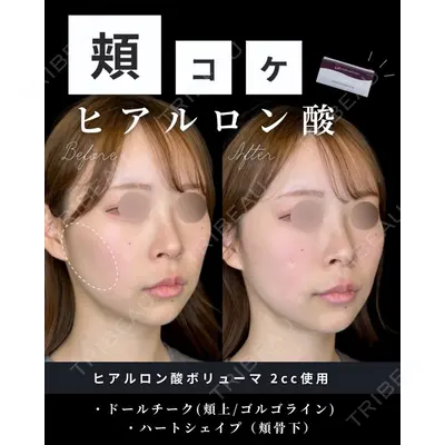 ルラ美容クリニック 大宮院 / ルラスキンクリニック 大宮院の症例