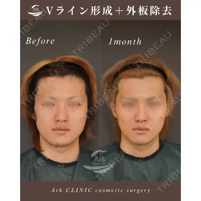 アーククリニック 加藤 雄大医師の症例