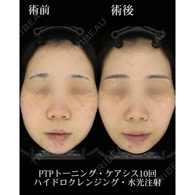 HAAB BEAUTY CLINIC 名古屋院の症例