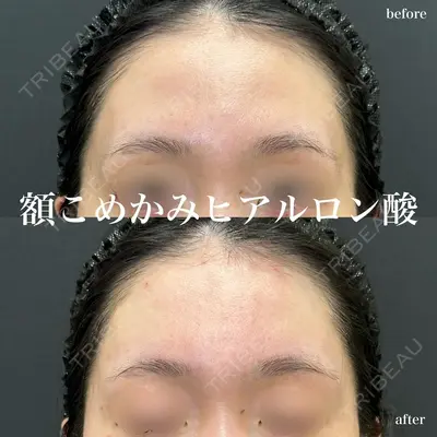 ルラ美容クリニック 名古屋栄院 / ルラスキンクリニック 名古屋栄院 関戸 優医師の症例