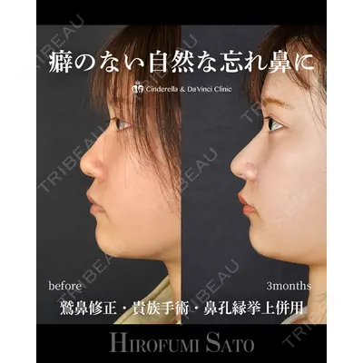 シンデレラ＆ダヴィンチクリニック 佐藤 博文医師の症例