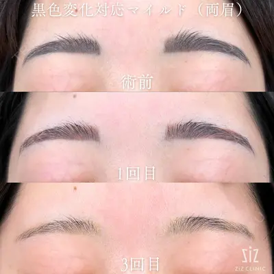 ziz CLINIC 村岡 史子医師の症例