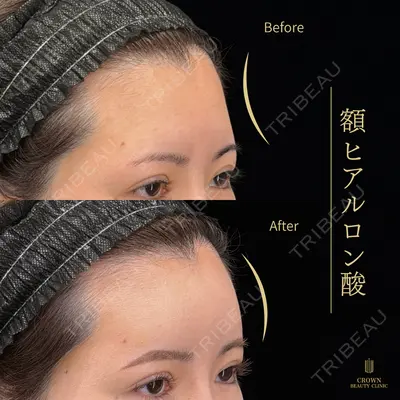 CROWN BEAUTY CLINIC 神山 豊医師の症例
