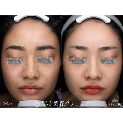 聖心美容クリニック 札幌院の症例