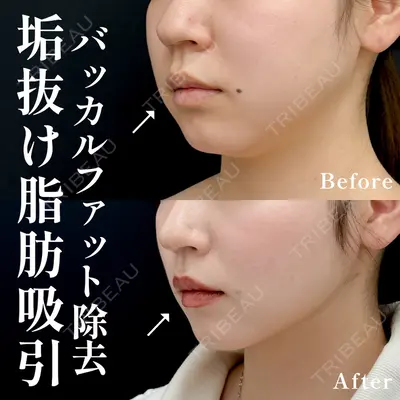 湘南美容クリニック 渋谷院 小草 智之医師の症例