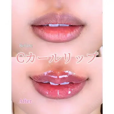 ルラ美容クリニック 広島院 角南 亮輔医師の症例