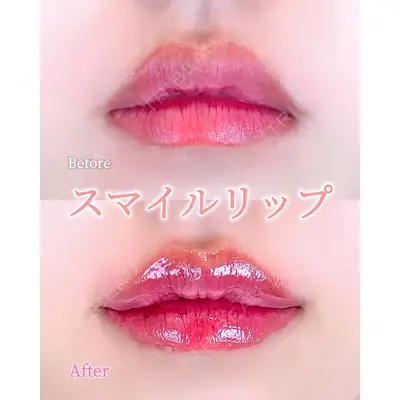 ルラ美容クリニック 広島院 角南 亮輔医師の症例