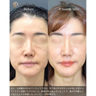 eクリニック 福岡院 伊藤 渉医師の症例
