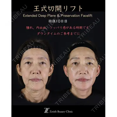 Zetith Beauty Clinic 新宿院 王 蘇医師の症例