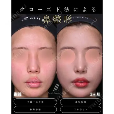 Zetith Beauty Clinic 福岡院 羽根 和秀医師の症例
