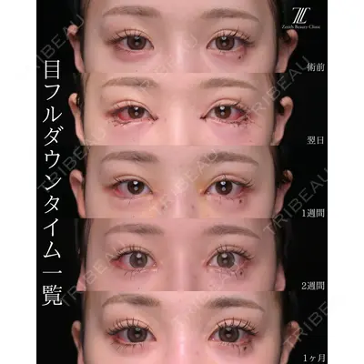 Zetith Beauty Clinic 大阪心斎橋院 楠本 拓哉医師の症例