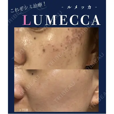 Pertica Clinica & Labcaの症例