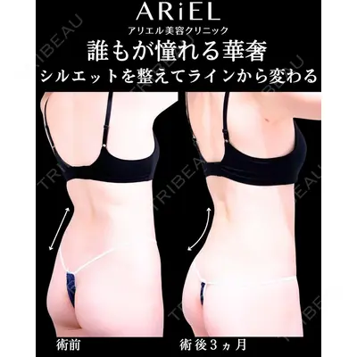 アリエル美容クリニック 横浜院 加藤 敏次医師の症例