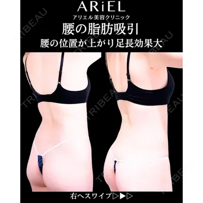 アリエル美容クリニック 横浜院 加藤 敏次医師の症例