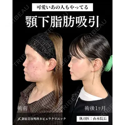新宿美容外科ネビュラクリニック 山本 紘子医師の症例