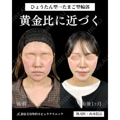 新宿美容外科ネビュラクリニック 山本 紘子医師の症例