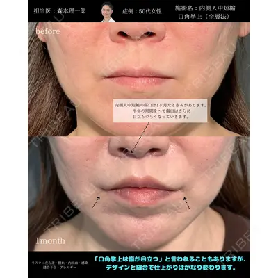 PRISM Beauty Clinic 町田院 森本 理一郎医師の症例