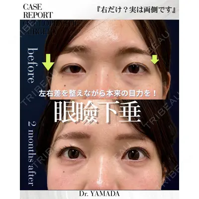 春山記念病院 山田 浩之医師の症例