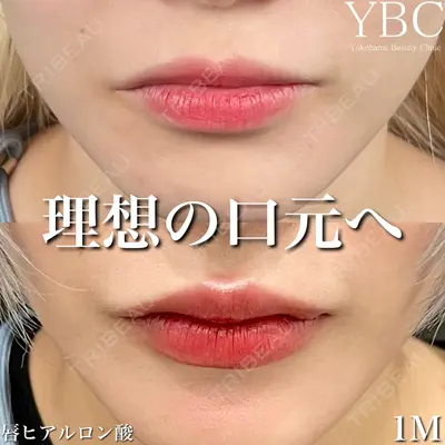 YBC横浜美容外科 池袋院 磯村 亮輔医師の症例
