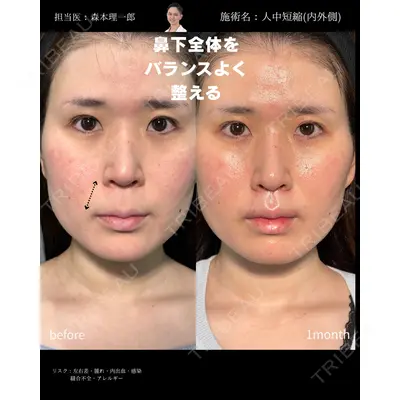 PRISM Beauty Clinic 町田院 森本 理一郎医師の症例