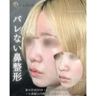 eクリニック 福岡院 伊藤 渉医師の症例