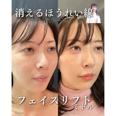 ルラ美容クリニック 渋谷本院 住友 沙織医師の症例