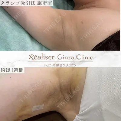 レアリゼ銀座クリニック 磯野 智崇医師の症例