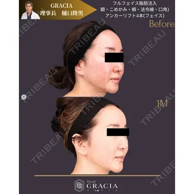 Casa de GRACIA GINZA 【カーサデグラシアギンザ】 樋口 隆男 理事長医師の症例