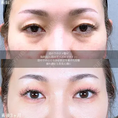 アリエル美容クリニック 大宮院 鈴木　桂介医師の症例