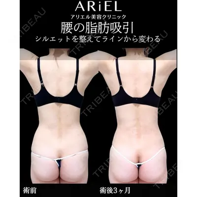 アリエル美容クリニック 横浜院 加藤 敏次医師の症例